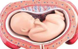 Патология при беременности: седловидная матка, возможно ли зачатие