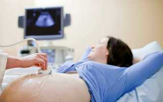 Что такое скрининговое обследование и когда его делают при беременности — подробное описание