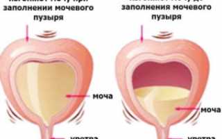 Проявления и лечение синдрома раздраженного мочевого пузыря