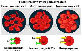 Что такое гипертонический раствор и как он действует?