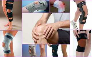 Как выбрать наколенники при артрозе коленного сустава: виды, цены, отзывы