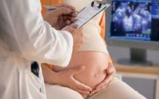 Причины появления ацетона в моче у беременных