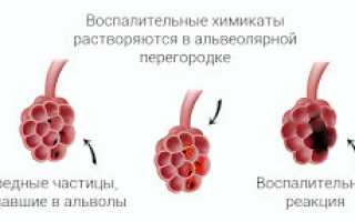 Кашель курильщика: развитие, признаки, как избавиться и лечить, последствия