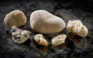 Симптомы проявления фосфатных камней в почках: причины, лечение и профилактика