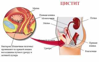 Отечественные и зарубежные аналоги препарата Уролесан