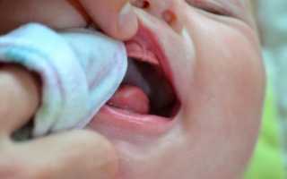 Молочница у детей во рту: причины, симптомы и лечение