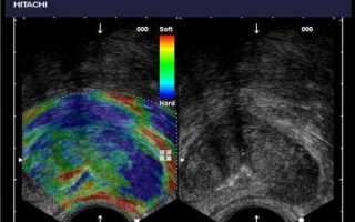 Что такое УЗИ с эластографией: описание методики, виды, показания, проведение