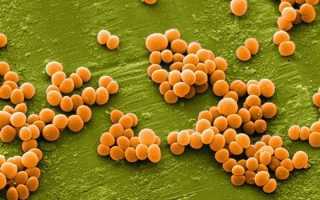 Staphylococcus spp – что это