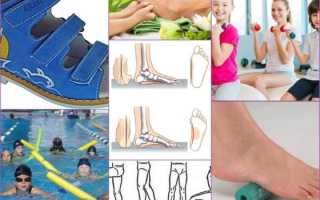 Упражнения для профилактики плоскостопия у детей и взрослых