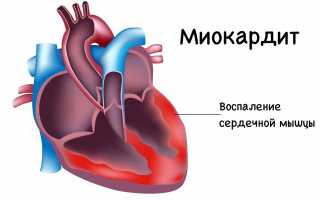 Не хватает воздуха при дыхании