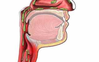 Мокрота: понятие, из чего состоит, виды и возможные цвета и диагностика по ним, обзор заболеваний