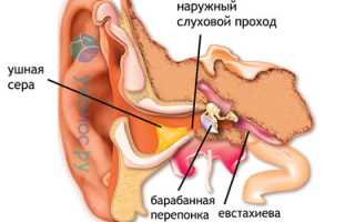 Ушная сера: функции, норма и патология, изменения цвета, количества, констистенции