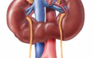 Причины аномального развития почек: виды, симптомы и лечение