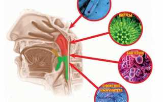Воспаление горла: факторы развития и формы, симптоматика, диагностика, терапия