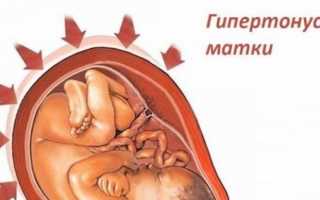Чем опасен гипертонус матки при беременности на ранних сроках