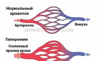 Чем может быть вызвана гиперемия лица?