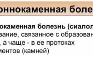 Слюннокаменная болезнь: причины, симптомы, последствия и лечение