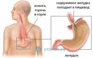 Горечь в горле: почему появляется, когда норма, заболевания-причины, как лечить