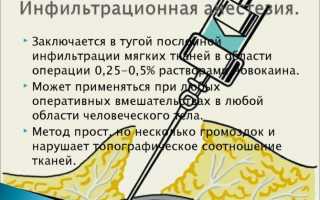 Инфильтрационная анестезия: виды, техника проведения, преимущества и недостатки