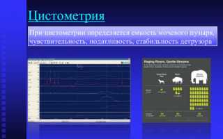 Уродинамика: что это такое, показания, методы исследования