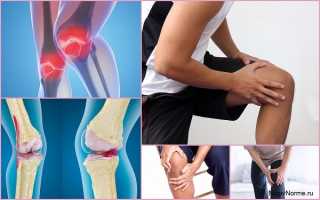 Остеоартроз коленного сустава 1 степени — что это такое и как его лечить?