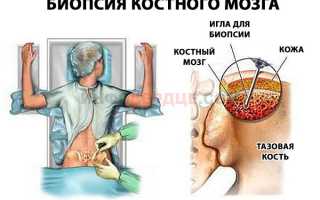 Что такое геморрагический диатез?