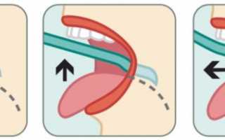 Правила ухода за зубами и полостью рта