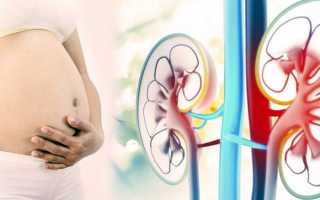 Опасен ли пиелонефрит при беременности