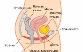 Непроизвольное мочеиспускание у женщин – причины, симптомы, лечение