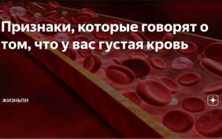 Как понять что у Вас слишком густая кровь и что делать?