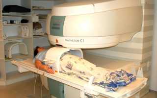 МРТ-обследование малого таза: что показывает и как подготовиться