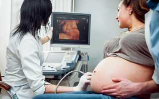 Что смотрят по УЗИ на 37-й неделе беременности и как выглядит плод, показатели нормы в таблице