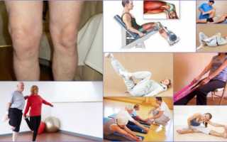 Лечебная гимнастика для коленных суставов при артрозе для пожилых