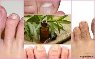 Как правильно применять эфирное масло чайного дерева от грибка ногтей на ногах?