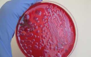 Streptococcus spp в мазке у мужчин