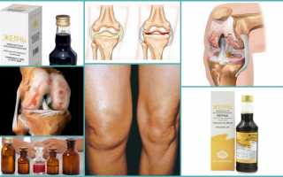 Применение медицинской желчи при артрозе коленного сустава