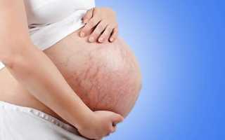 Почему просвечиваются вены на животе при беременности
