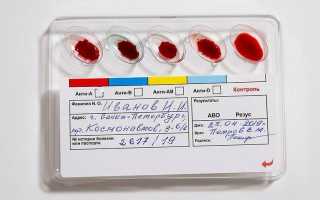 Для чего необходим анализ крови для определения группы и резус-фактора при беременности