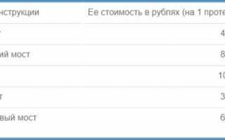 Виды зубных мостов, какие лучше, как ставят и сколько они стоят