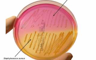 Эпидермальный стафилококк: характеристика, патогенность, диагностика, лечение