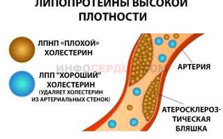 Липидограмма: что это за анализ и для чего он проводится?