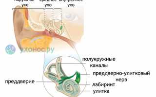 Лабиринтит (воспаление внутреннего уха): как лечить, причины