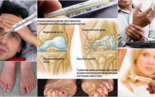 Почему повышается температура при ревматоидном артрите и что с этим делать?