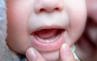 Прорезывание зубов у ребенка: признаки, порядок, чем помочь