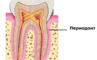 Периодонтит зуба – что это такое и как его лечить