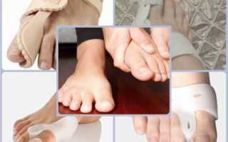 Ортопедические фиксаторы для косточки на ноге — обзор и отзывы
