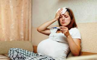 Грипп при беременности: чем опасен, как лечить, методы профилактики