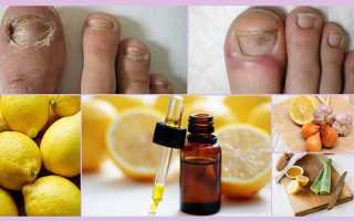 Лечение грибка ногтей лимоном