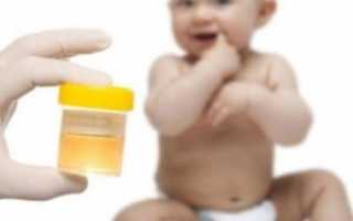 Протеинурия у детей — сигнал заболеваний почек или мочеполовой системы