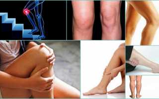 Симптомы и лечение тромбов в ноге под коленом сзади